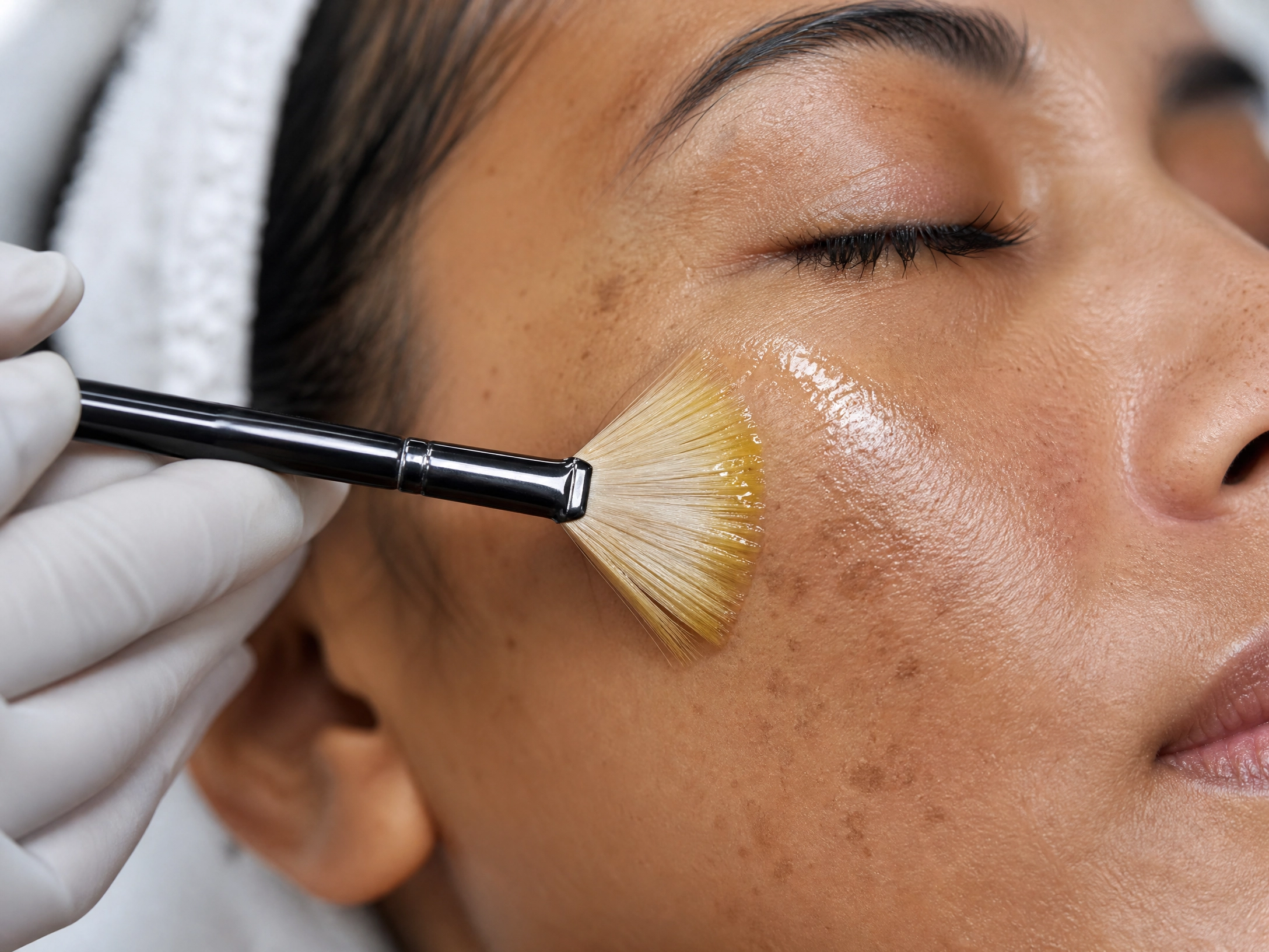 Treatment result