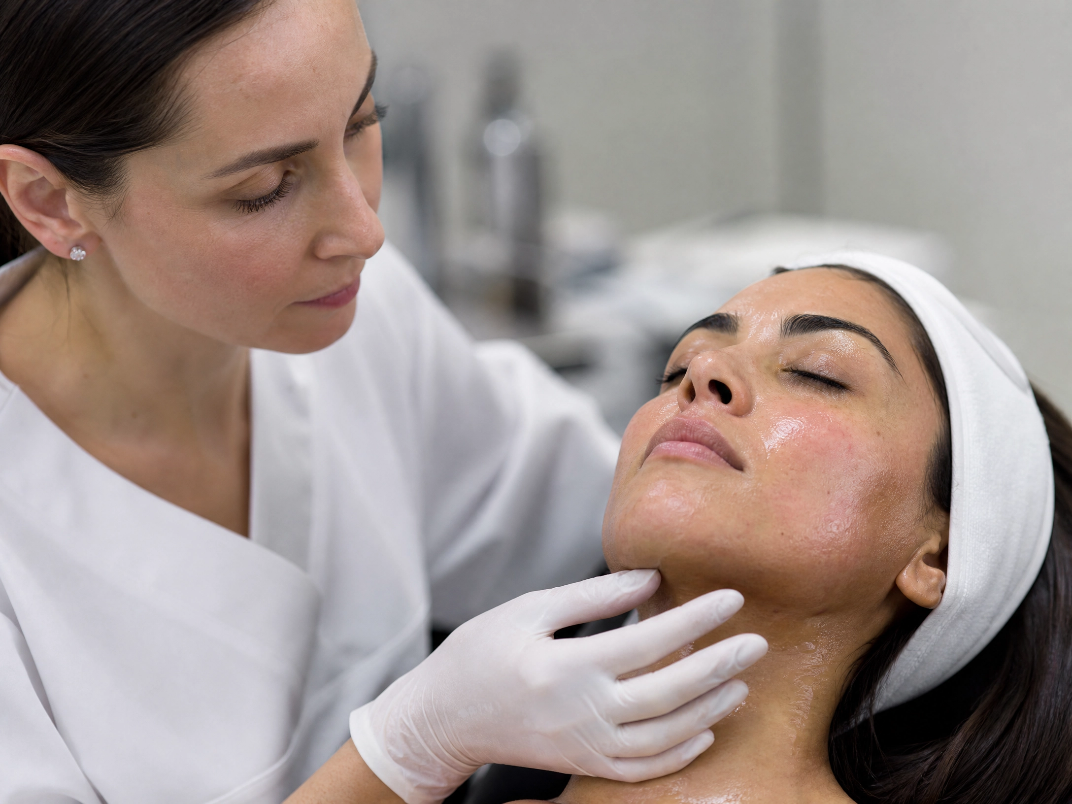 Advanced Chemical Peel for Melasma, Hyperpigmentation & Dark Spots