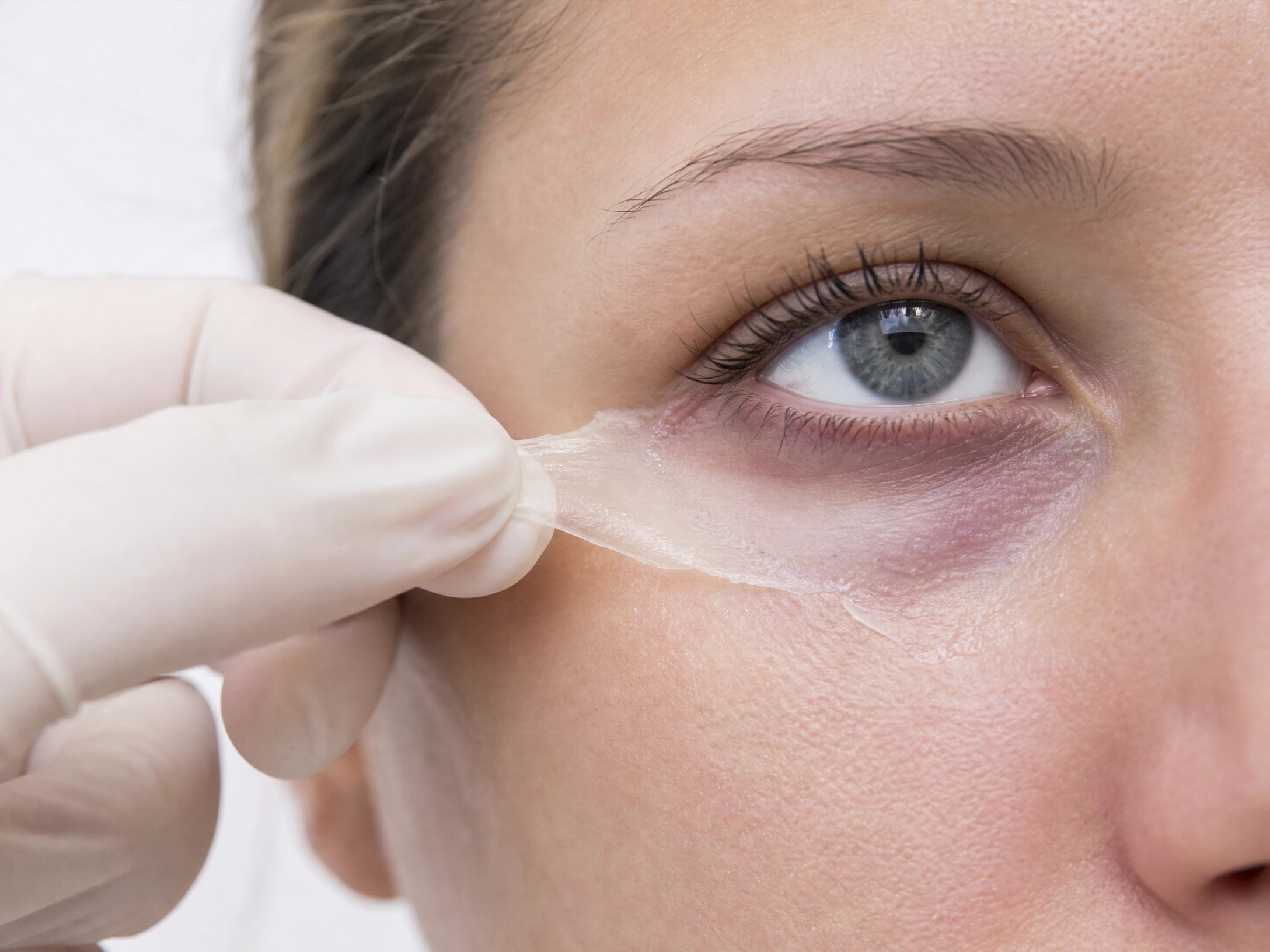 Treatment result